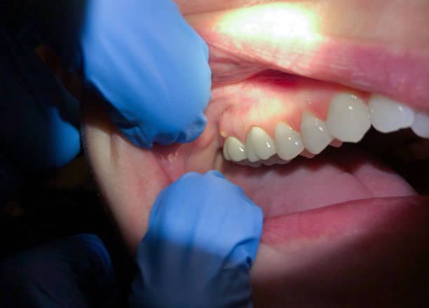 Best Urgent Dental Care in Dobson, NC