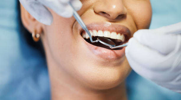 Best Emergency Wisdom Teeth Removal in Dobson, NC